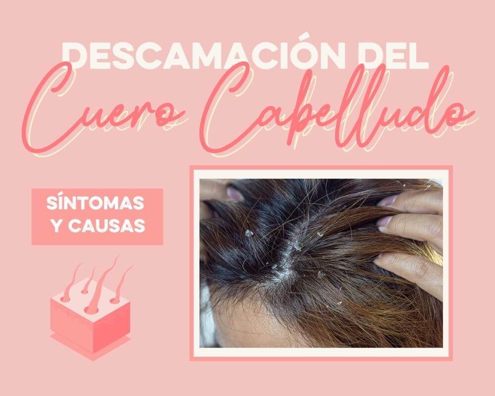 descamación cuero cabelludo seco